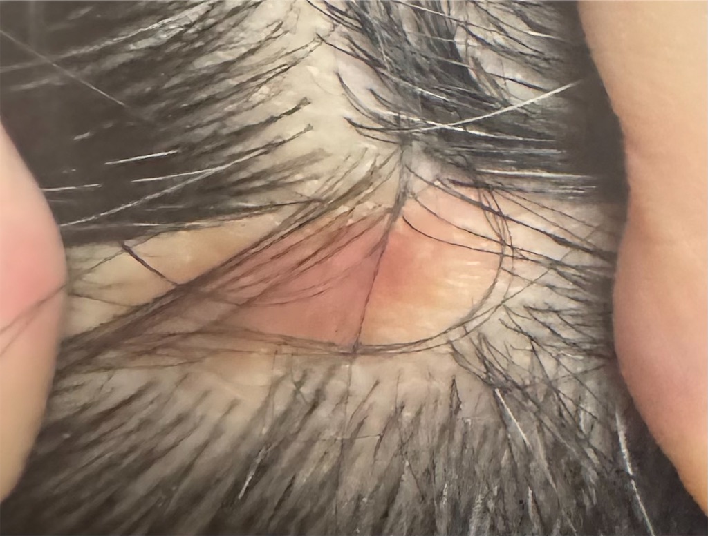 f:id:utane_channel:20240525201205j:image